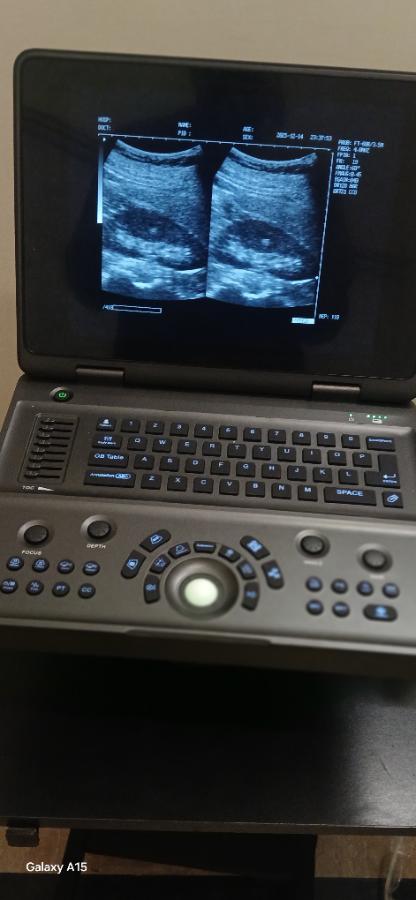 NOTEPAD DIGITAL ULTRASOUND MACHINE